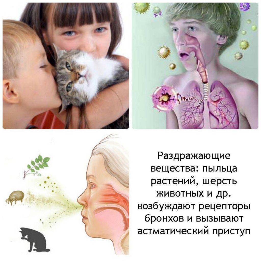 Аллергия на кошек у детей: причины, симптомы, методы диагностики и терапия