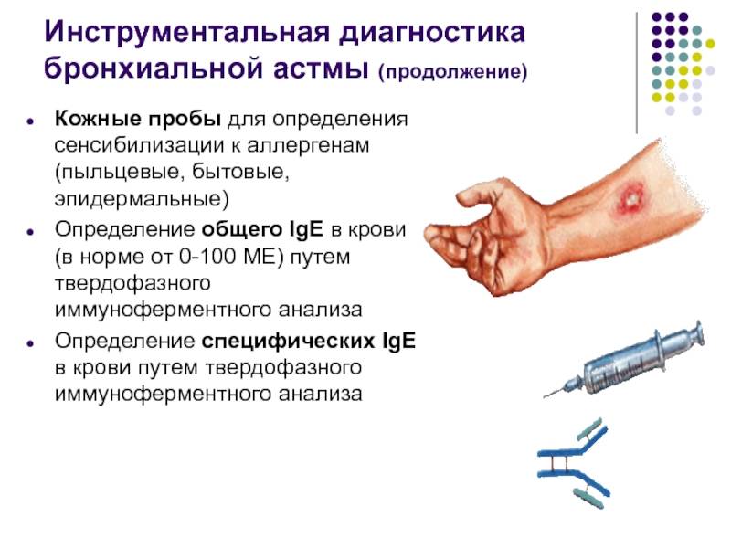 Анализ на аллергены у ребенка: сдача крови, кожные пробы, провокационный тест при аллергии