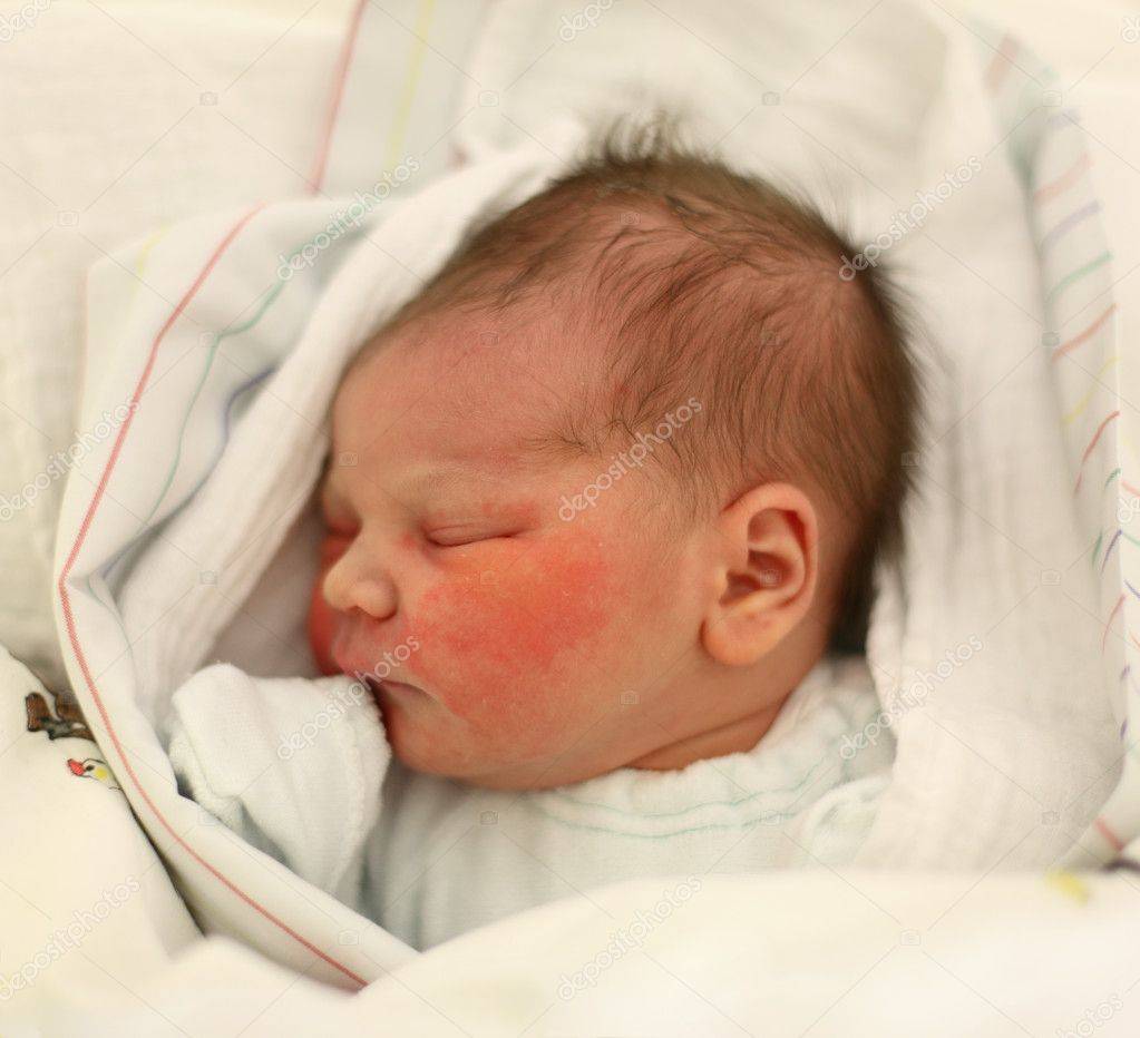 Что делать если у грудничка холодный лоб | ru-babyhealth