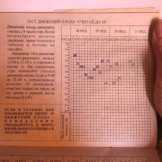 О чем расскажут шевеления плода? как правильно считать количество шевелений?  | гинекология.инфо