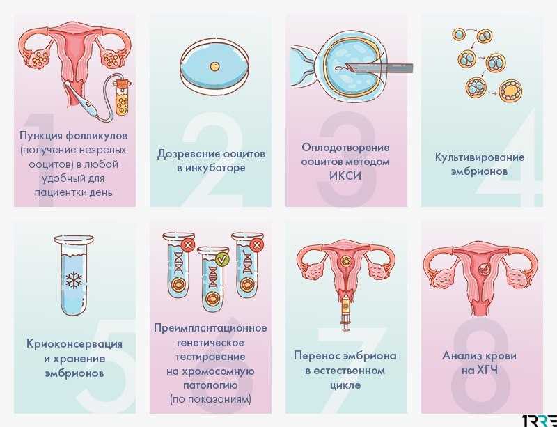 Пункция фолликулов при эко - этапы, наркоз, самочувствие после процедуры