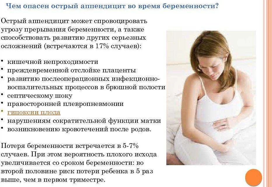 Аппендицит при беременности: симптомы и первый признаки, возможные последствия