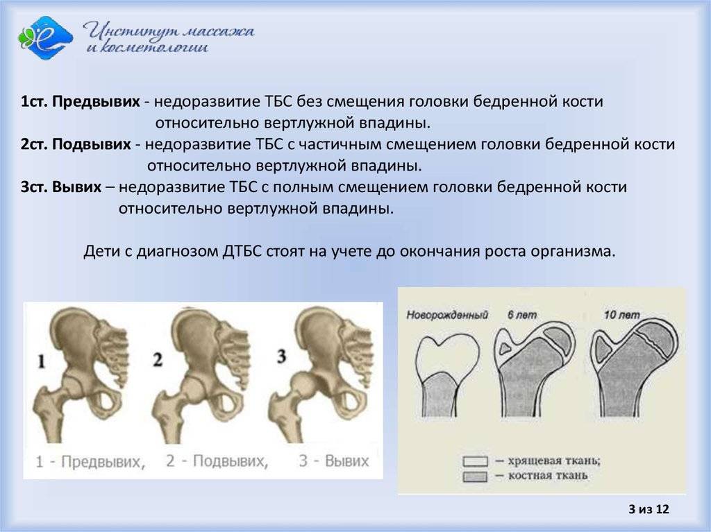 Дисплазия тбс у детей