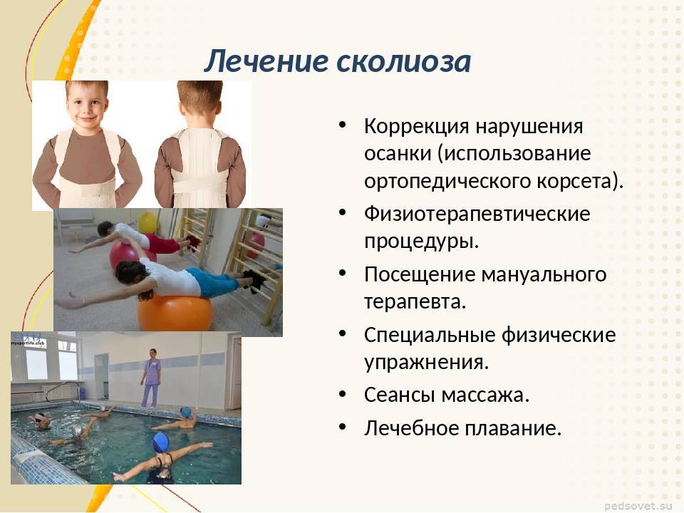 Лфк при сколиозе 1 и 2 степени: комплекс упражнений. рекомендации врача лфк