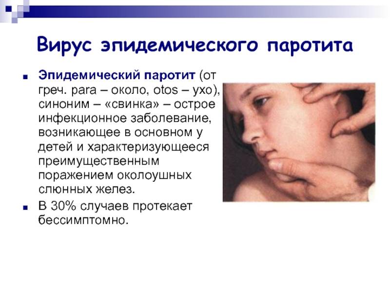 Паротит: симптомы у детей и взрослых, причины, лечение, диагностика, прививка | азбука здоровья