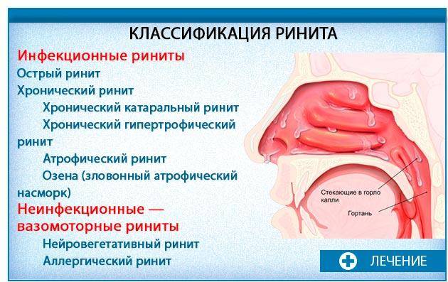 Постоянные сопли и насморк у ребенка: что делать и как вылечить затянувшийся ринит