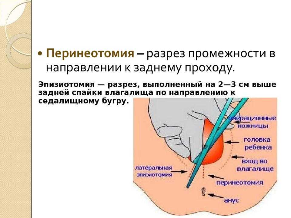 Мнение врачей, когда можно заниматься сексом после родов?