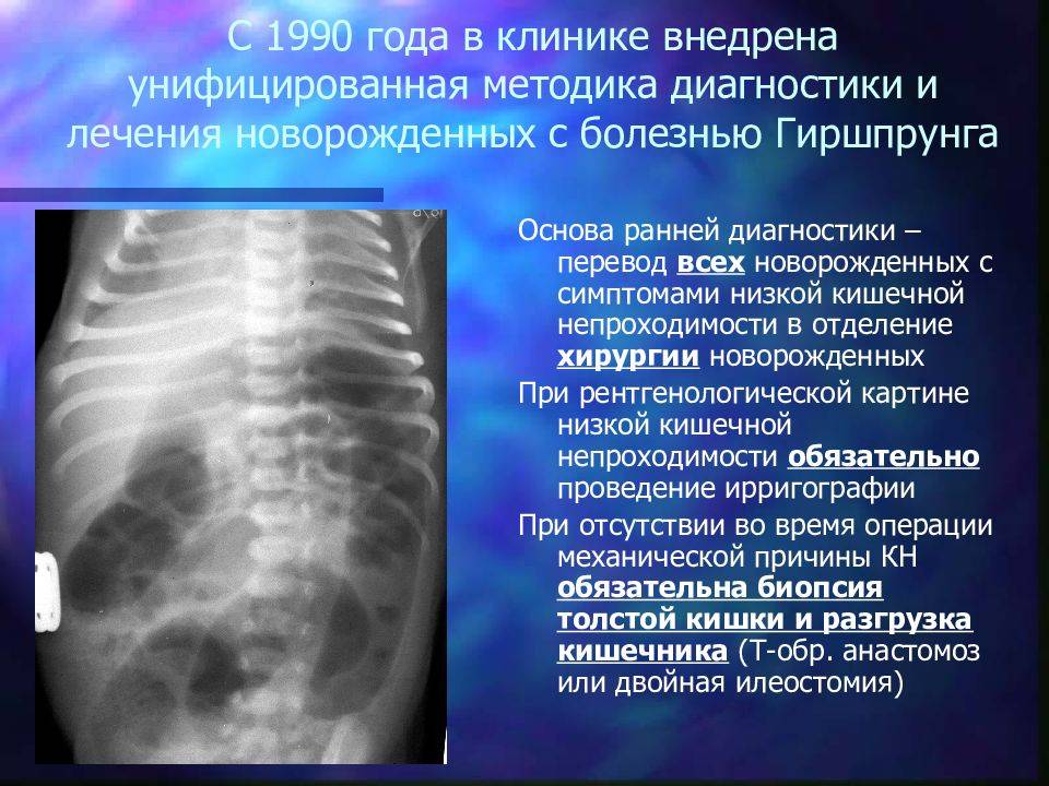 Болезнь гиршпрунга у детей - симптомы болезни, профилактика и лечение болезни гиршпрунга у детей, причины заболевания и его диагностика на eurolab
