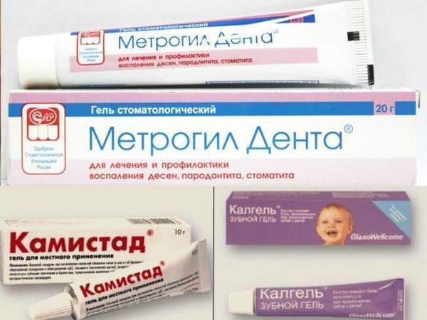 Лекарство от стоматита для детей: лучшие мази, гели, спреи и таблетки для лечения рта