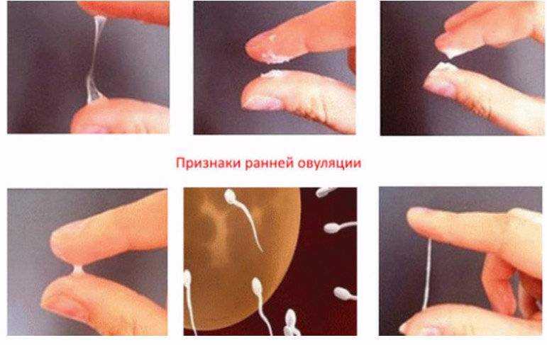 Месячные с прозрачной слизью и сгустками: причины | oldchampionat.ru