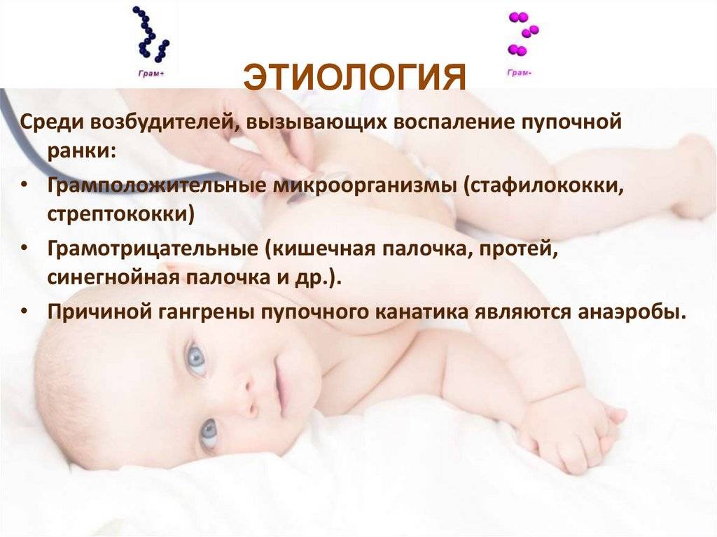 Гнойный омфалит: причины, симптомы и лечение воспаления пупка у новорожденных