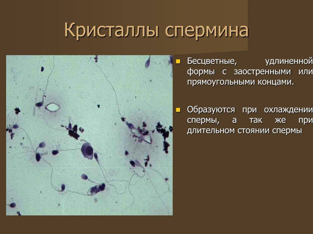 Что означает диагноз «нормозооспермия» у мужчин, хорошо это или плохо?