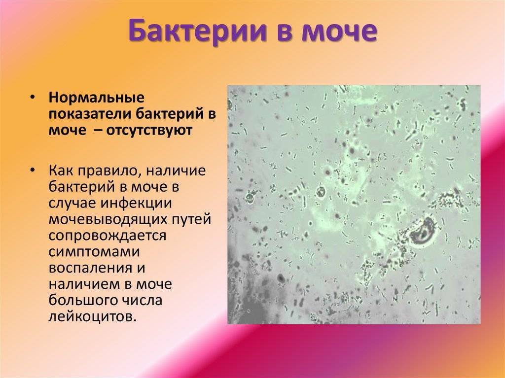 Нитриты в моче