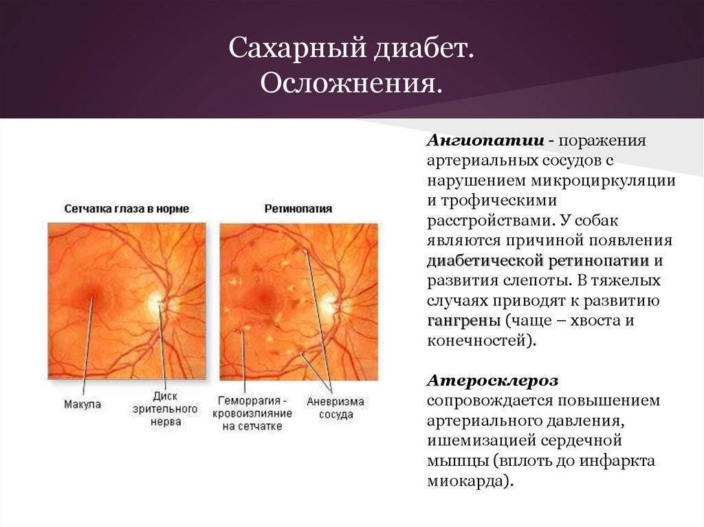 Диагностирование ангиопатии сетчатки у ребенка. причины, симптоматика, лечение, осложняющие факторы