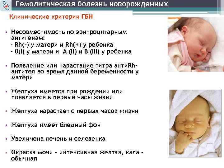 Кандидозный стоматит у детей