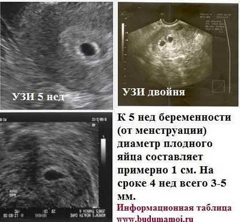 Какое узи делают на раннем сроке беременности. Как выглядит эмбрион в 6 недель на УЗИ. УЗИ плодное яйцо в матке 3 недели беременности. Как выглядит эмбрион в 5 недель на УЗИ. УЗИ 6 недель беременности плодное яйцо на УЗИ.