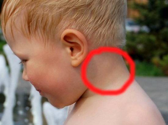 У ребенка на голове под кожей появилась шишка в виде шарика: что это может быть и как лечится?