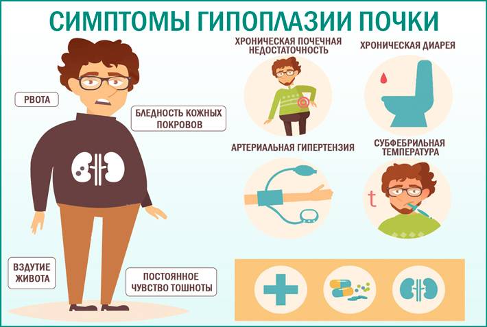 Причины гипоплазии почки у ребенка, симптомы патологии и способы лечения