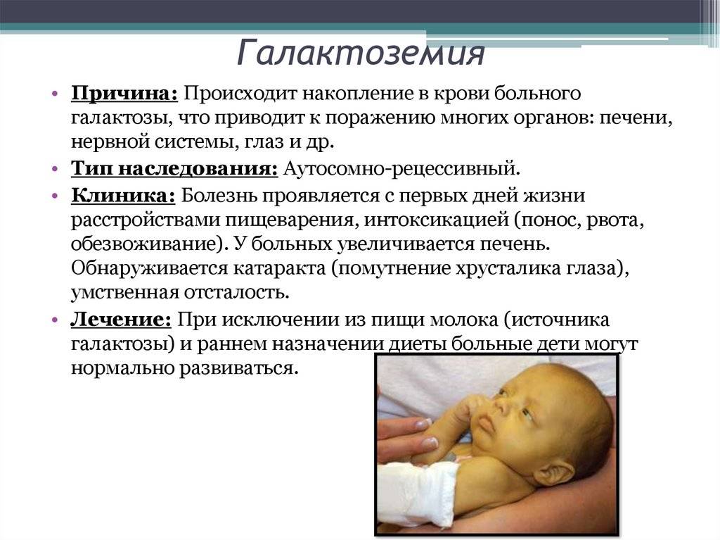 Токсическая и физиологическая формы эритемы у новорожденных: симптомы с фото и лечение