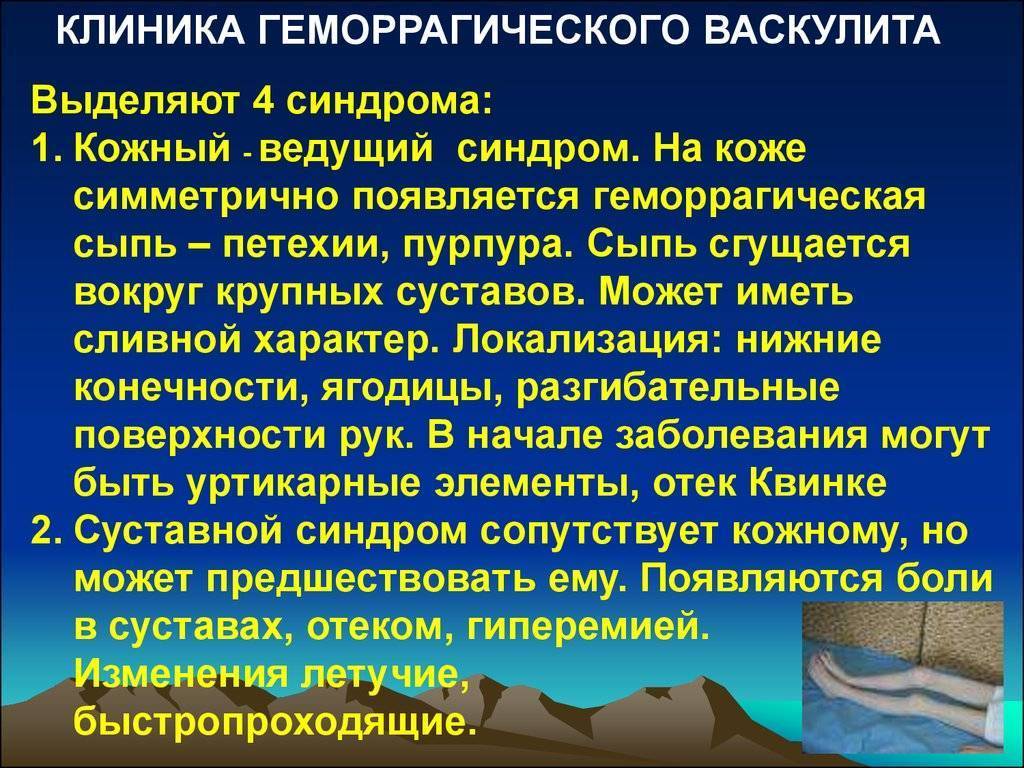 Геморрагический васкулит у детей —  что это за болезнь?