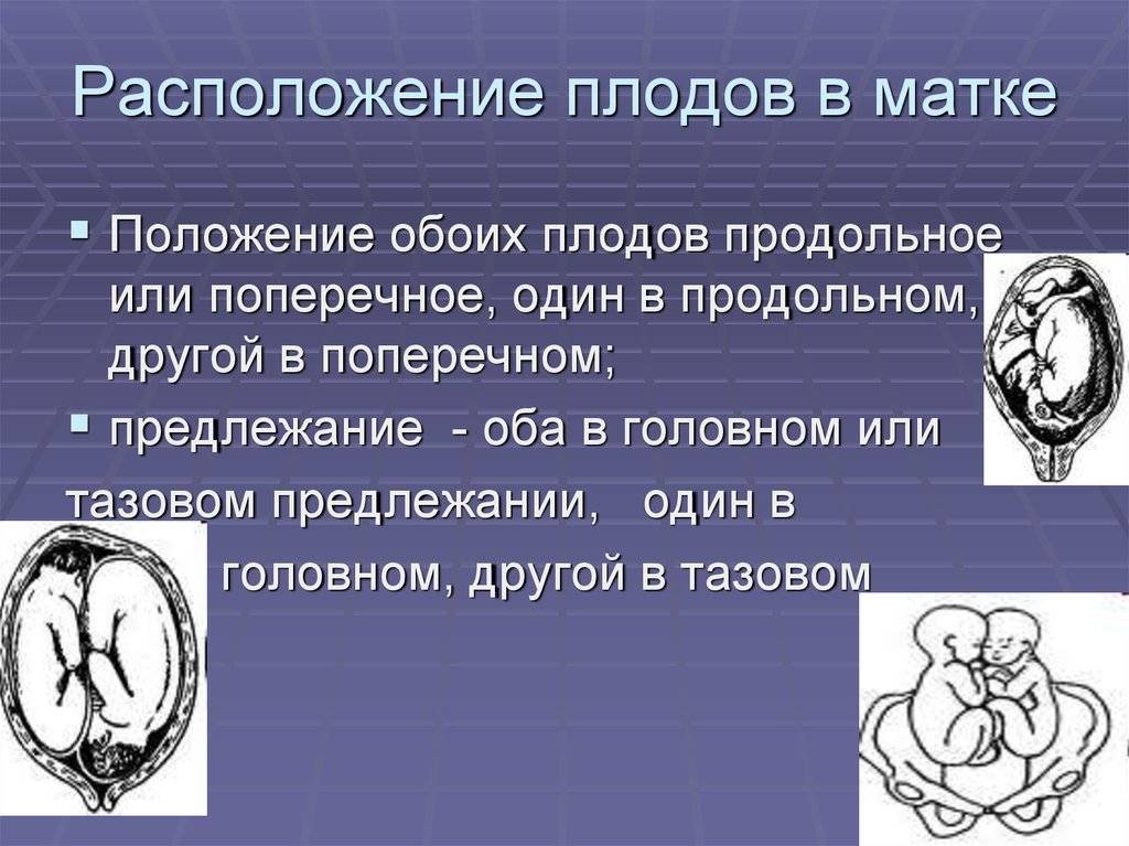 Что значит заключение о неустойчивом положении плода, хорошо это или плохо?