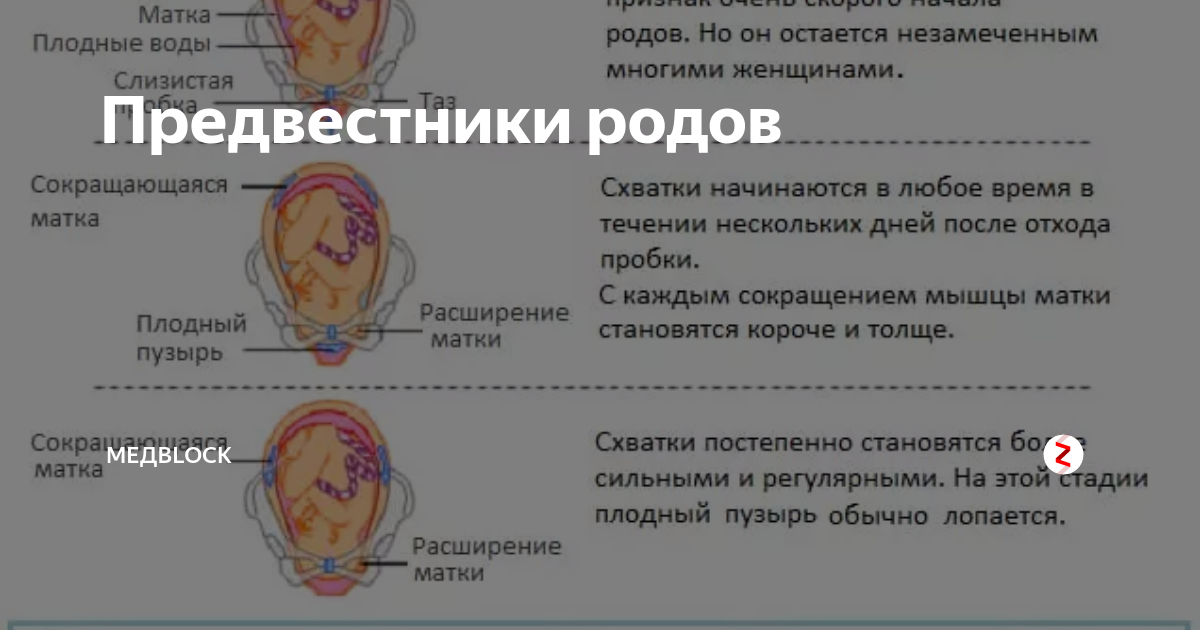 Слизистая пробка у беременных – как выглядит и когда отходит