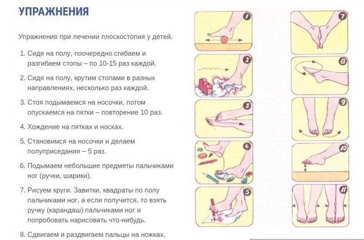 Массаж при плоскостопии у детей, упражнения в домашних условиях (видео ЛФК)