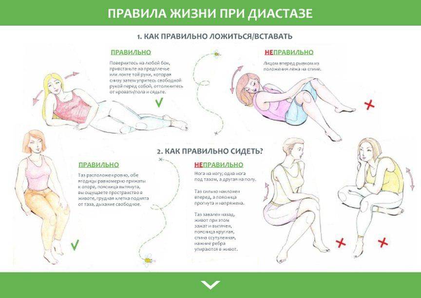 Что происходит со стулом после кесарева сечения и как себе помочь