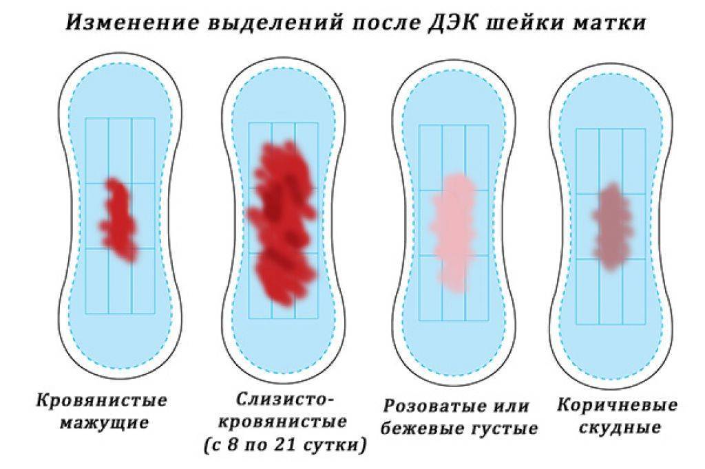 Выделения после выскабливания полости матки: показатель качества восстановления женского организма