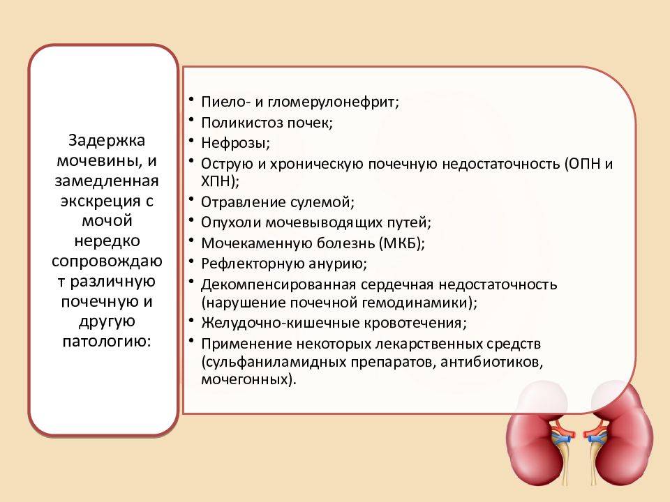 Гидронефроз левой почки: степени, причины, симптомы и лечение