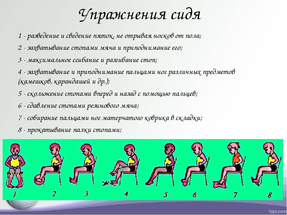 Упражнения для стопы при поперечном плоскостопии у взрослых - комплекс лфк