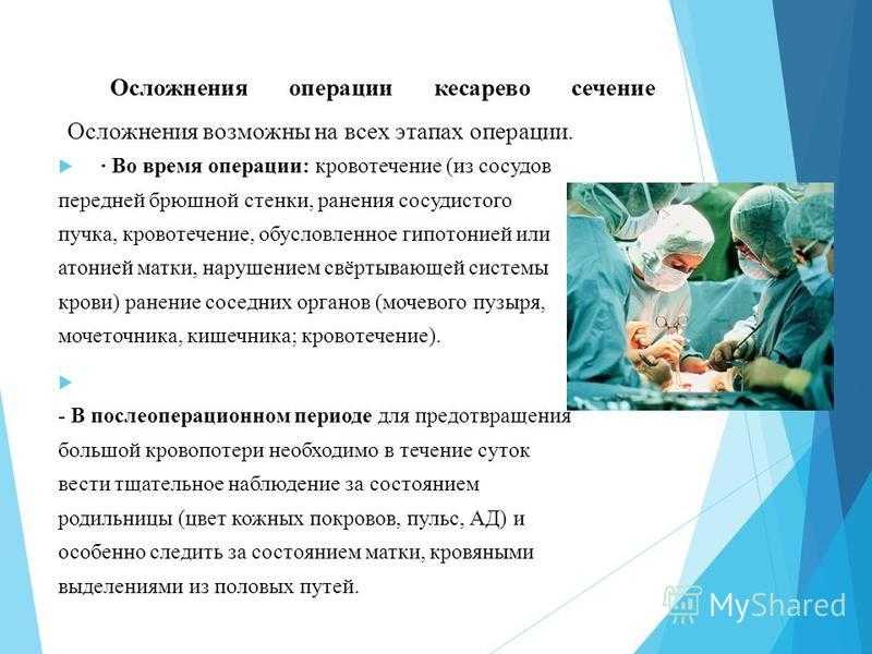 Грудное вскармливание после кесарева сечения: когда приходит молоко?