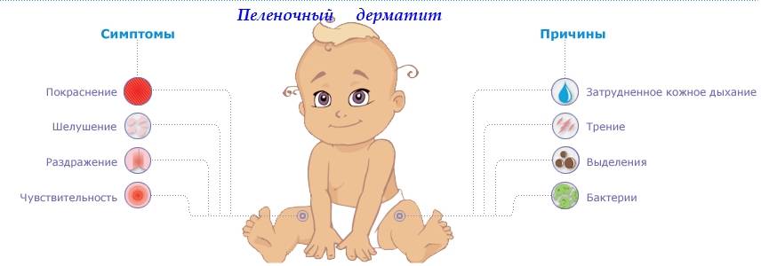 Высыпания в паху у детей