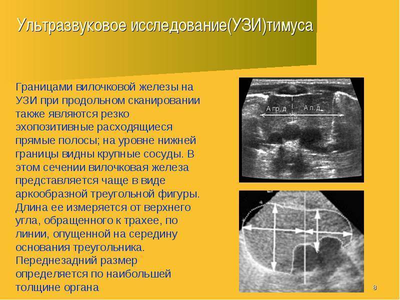 Вилочковая железа (тимус) у детей: общая характеристика патологий и методы лечения