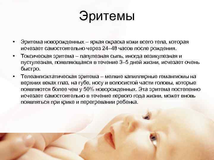 Как отличить аллергию от цветения у новорожденных – отличие симптомов