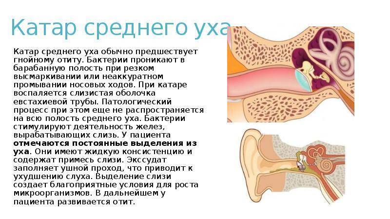 Отит у ребенка: симптомы, диагностика, лечение
