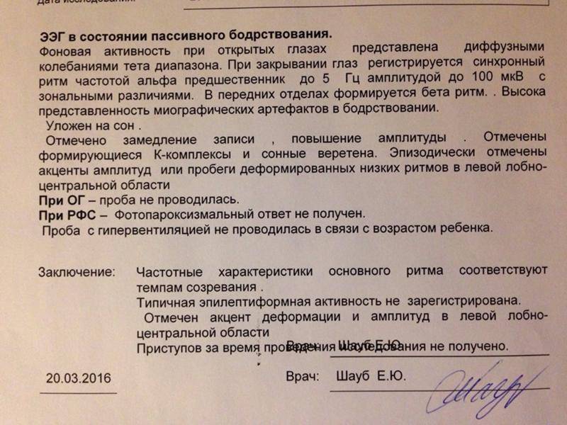 Помощь в расшифровке ээг: все, что вам нужно знать