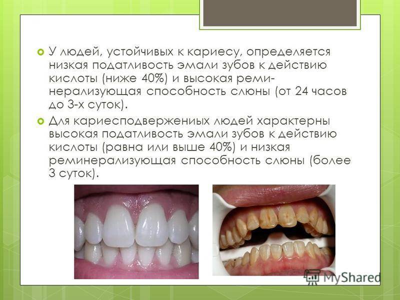 Желтый налет на зубах у ребенка: причины, разновидности, профилактика