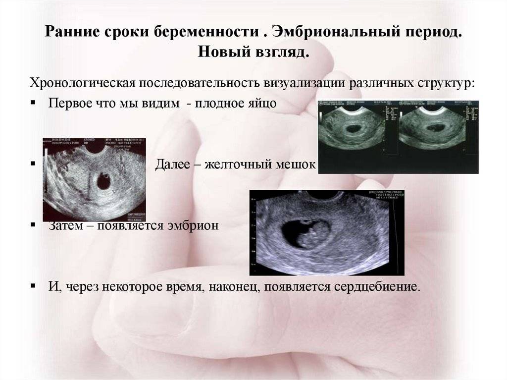Самые первые признаки беременности до задержки месячных: список