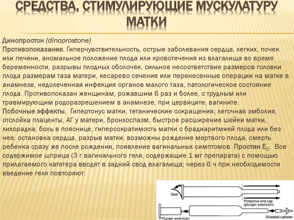 Стимуляция родов в роддоме: как происходит ламинарией, гелем и другими методами, возможные осложнения, отзывы и рекомендации
