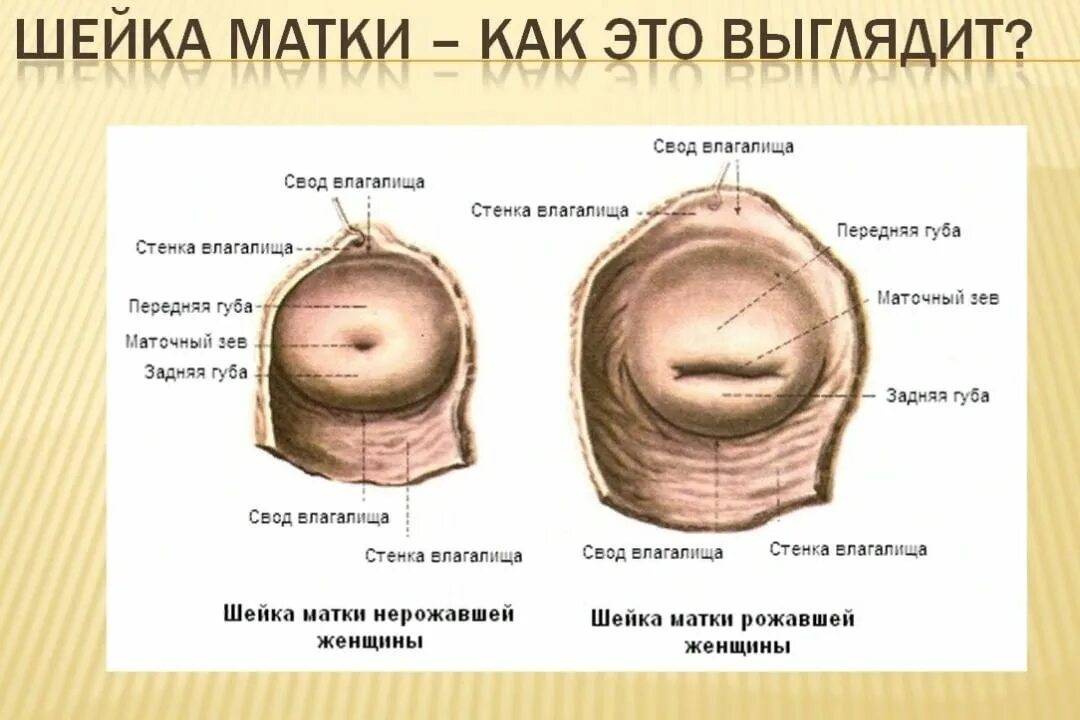 Как определить признаки беременности по шейке матки — как определить беременность по шейке матки — центр гинекологии и акушерства