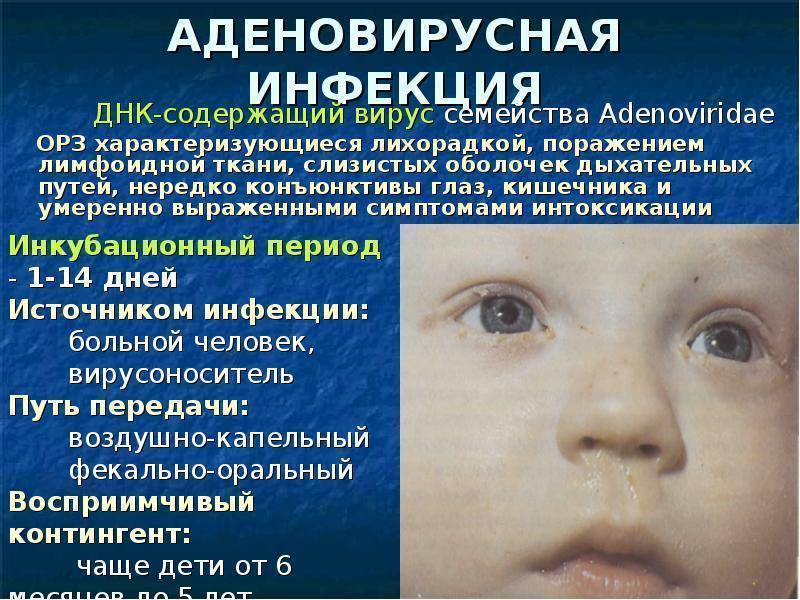 Аденовирусная инфекция у детей