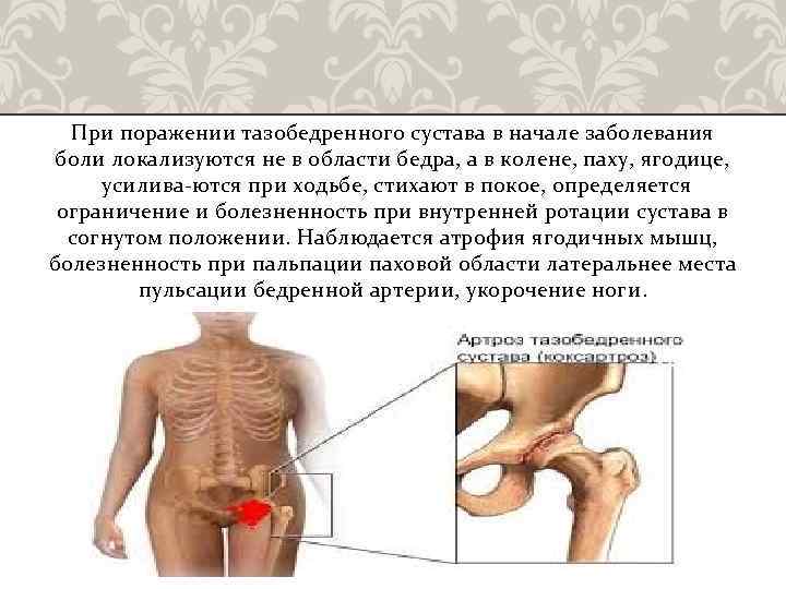 Отдает в пах у мужчин причины. Болит в области тазобедренного сустава. Боль в тазобедренном суставе спереди. Локализация боли при воспалении тазобедренного сустава. Болит левый тазобедренный сустав.
