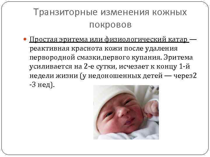 Эритема новорожденных: лечение и причины токсической и физиологической неонатальной эритемы, когда она проходит