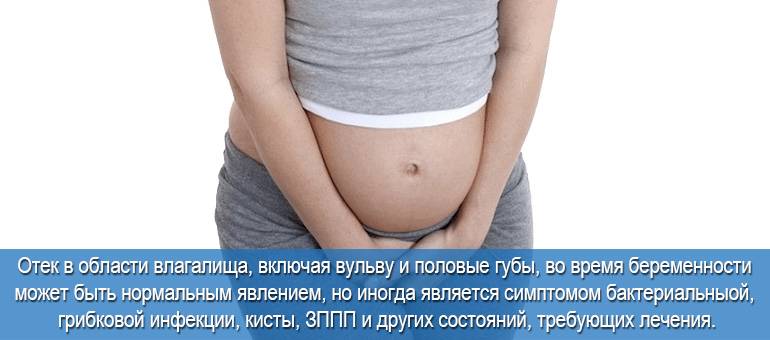 Во время беременности набухают половые губы. во время беременности опухают, болят или чешутся половые губы: почему это происходит и что делать? проходит ли болезнь после беременности