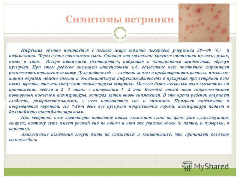 Ветрянка у детей без температуры: может ли быть, протекает ли при малом количестве высыпаний?