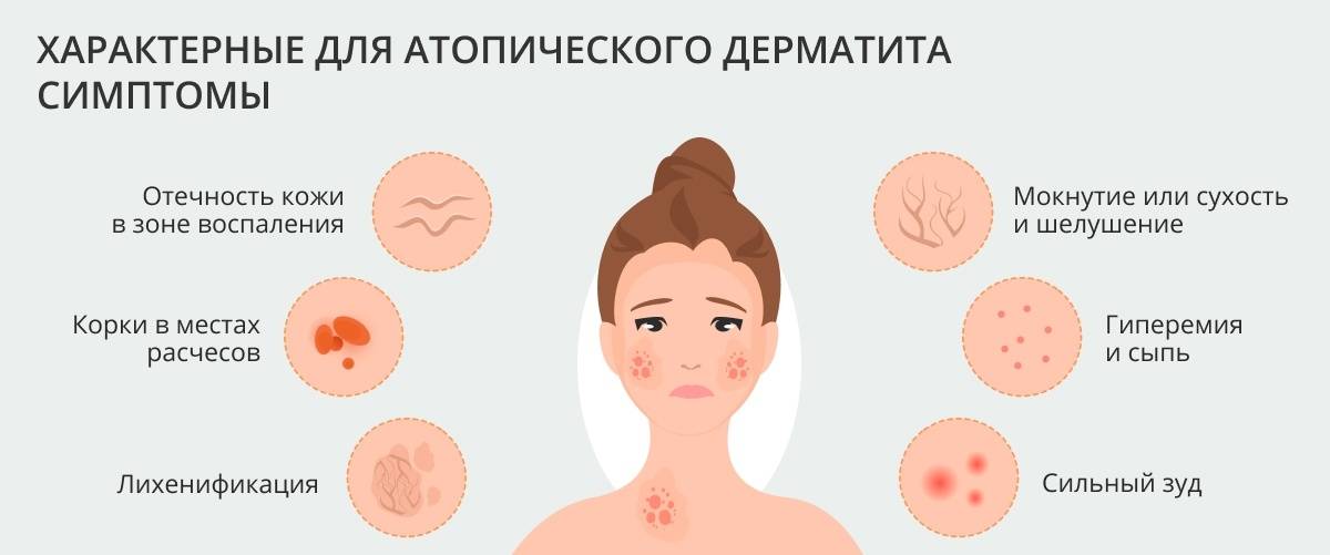 Как выглядит аллергия на коже у детей и взрослых, фото