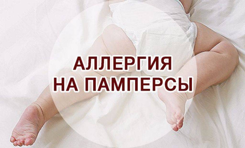 Аллергия на памперсы: фото, симптомы и лечение у детей