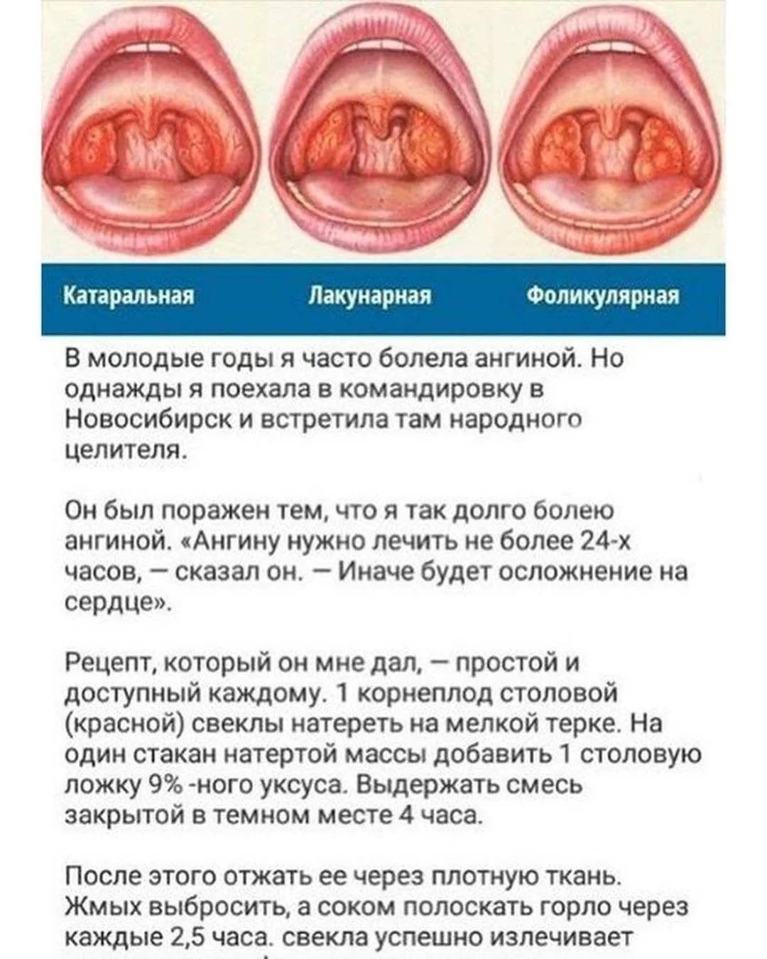 Красное рыхлое горло у ребенка: причины, лечение