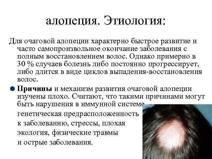 Алопеция у детей: очаговая, гнездная, причины и лечение | prof-medstail.ru